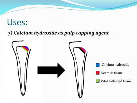 PPT - Calcium Hydroxide and its uses PowerPoint Presentation, free download - ID:4707579