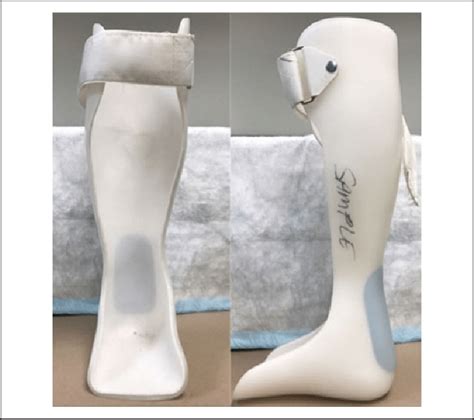 The molded ankle-foot orthosis (MAFO). | Download Scientific Diagram