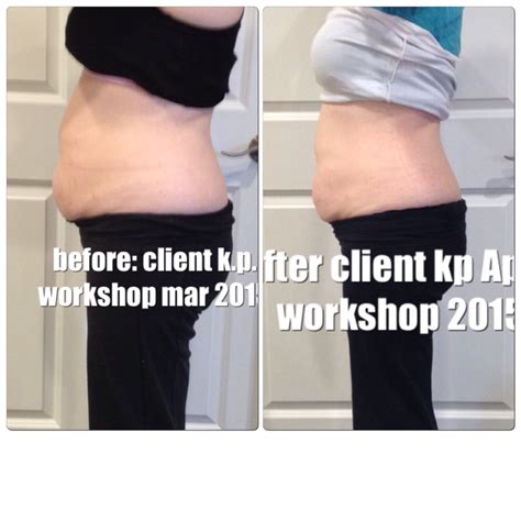 All New Before and After Pictures – Healing the Diastasis Recti 2015 – Beautiful After the Belly