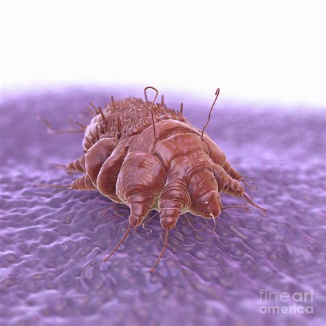 Scabies Bug Pictures