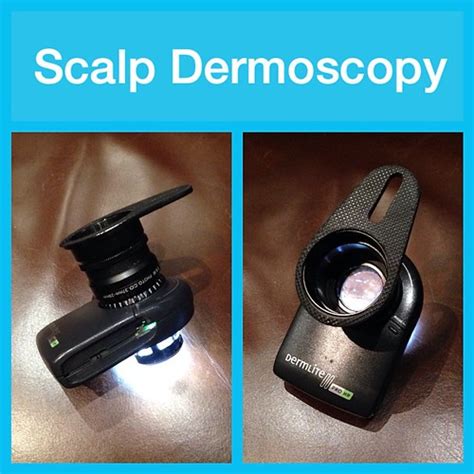 Scalp Dermoscopy. A "dermatoscope" is a hand held device t… | Flickr