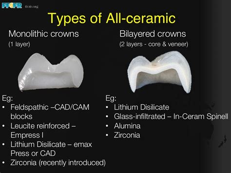 Fixed Prosthodontics SlideShare