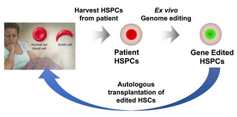 New genetic weapons challenge sickle cell disease | Ken Kennedy Institute | Rice University