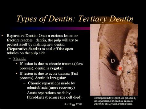 The Histology of Dentin Pauline Hayes Garrett D