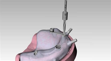 Cad medical - daserfx