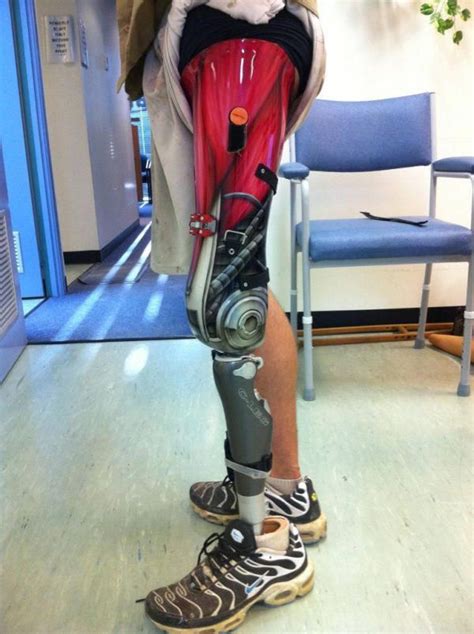 http://www.slightlywarped.com/crapfactory/curiosities/2011/march/awesome_prosthetic_leg.htm ...