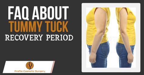 FAQ About Tummy Tuck Recovery Period – Blog – Profile Studios