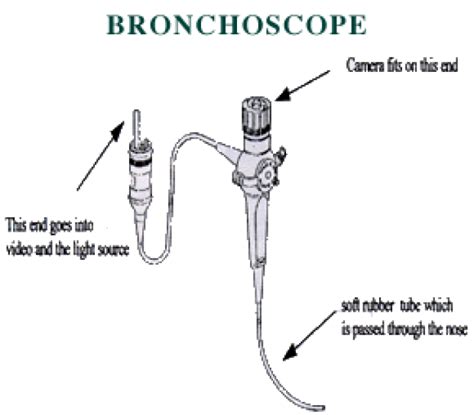 Bronchoscopy | The Cystic Fibrosis Center at Stanford | Stanford Medicine