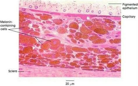 Choroid | Histología