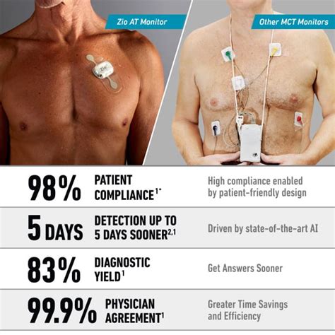 Uninterrupted Mobile Cardiac Telemetry - Zio AT