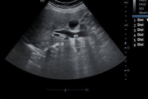 Gallbladder Ultrasound Jeopardy Template