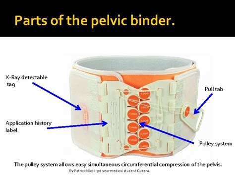 Applying a Pelvic Binder By Patrick Nicol 3