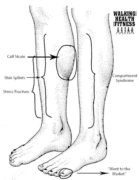 Leg Pain Calf Muscle