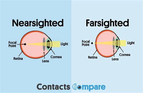 how do contact lenses work for farsightedness - Marianna Byrne