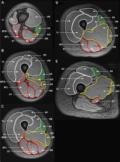 Illustration of segmented MRI ACSAs of the thigh at a 20 %, b 40 %, c ...