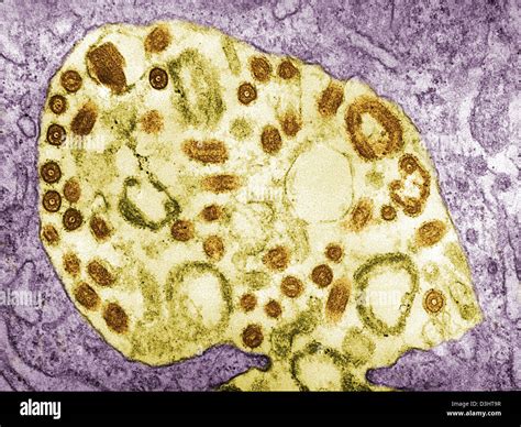 Marburg virus hi-res stock photography and images - Alamy