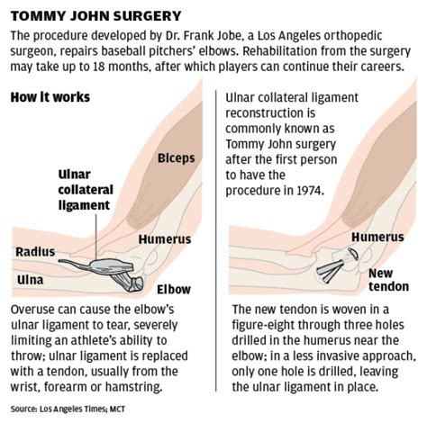 'Tommy' turnarounds : Sports