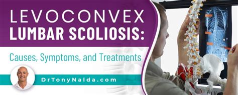 Levoconvex Lumbar Scoliosis: Causes, Symptoms, & Treatment