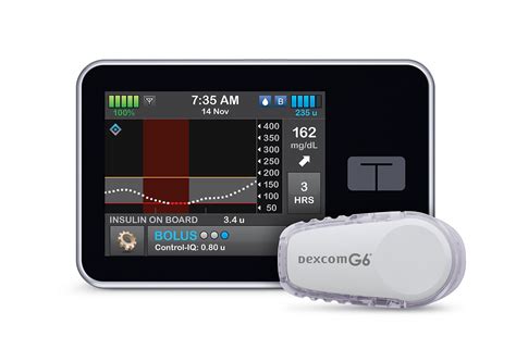 What’s the Deal with the Extended Bolus or Dual/Square Wave Bolus?