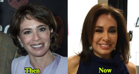 Jeanine Pirro before and after - Latest Plastic Surgery Gossip And News ...