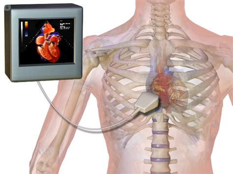 Echocardiogram: what is it, symptoms and treatment | Top Doctors