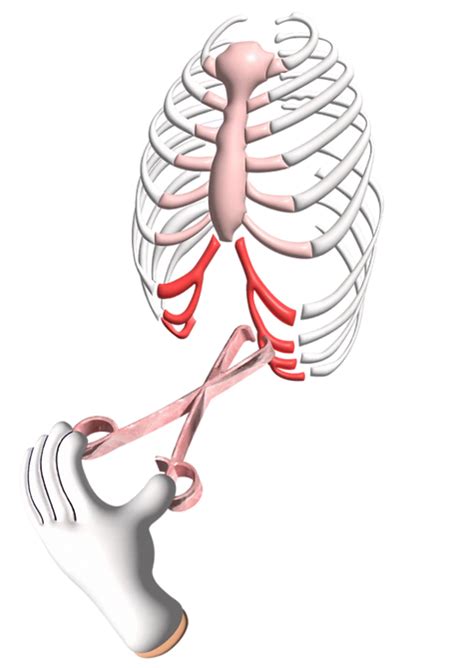 Rib Flare Removal Treatment - Dr. Pectus - Turkey - drpectus.com