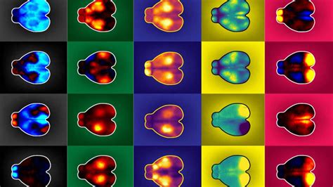 Mice fidget. Those motions have big effects on their brains