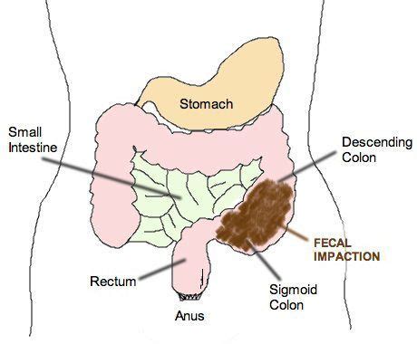 You May Be Constipating Yourself And Not Know It – Plus Ways To ...