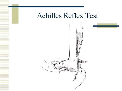 Orthopaedic Neurology Diagnostic Guide to Neurological Levels Motor