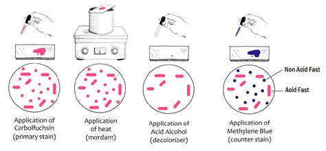 Ziehl-Neelsen Stain (ZN-Stain) : Principle, Procedure, Reporting and Modifications ...