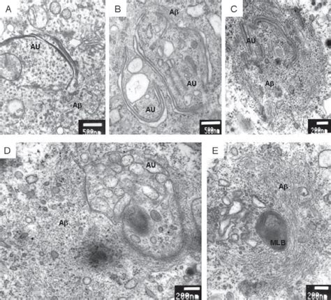 A-E. Sequence of electron microscopy photographs showing autophagic... | Download Scientific Diagram