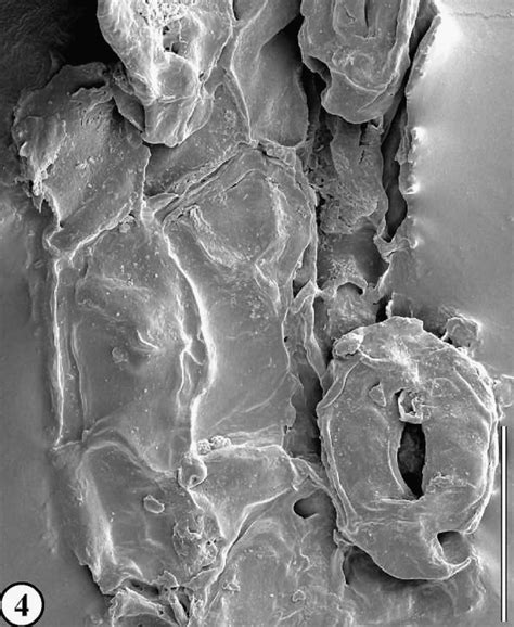 Even Type of cuticle characterized in a fossil Metasequoia leaf from... | Download Scientific ...