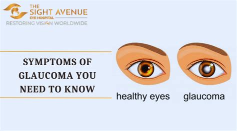 Symptoms of Glaucoma You Need to Know