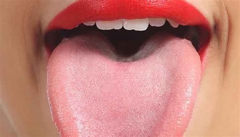 Changes in Tongue Appearance May Indicate COVID-19 Infection ...