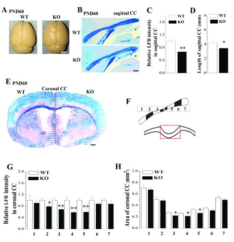 Loss of Nsun5 causes corpus callosum (CC) agenesis with... | Download ...