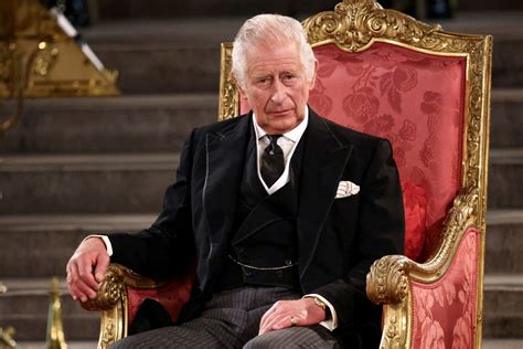 King Charles to Undergo 'Corrective Procedure' for Medical Condition