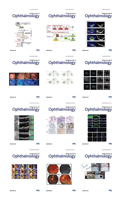 British Journal of Ophthalmology 2022 Full Archives - Ophthalmology Library