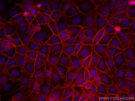 Beta Catenin antibody (CL594-17565) | Proteintech