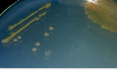 Figure 1 from Isolation, Identification and Pathogenicity of Flavobacterium columnare SGM4 in ...