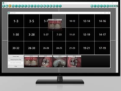 New Dental Product: DEXIS Eleven Imaging Software from DEXIS | Dental News