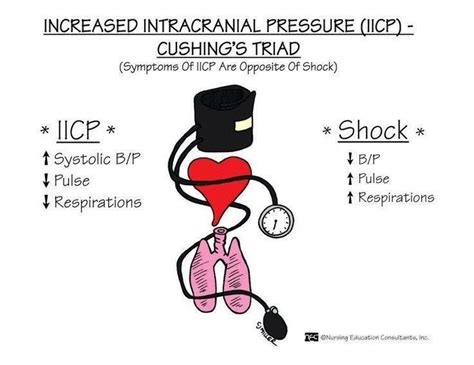 ICP vs Shock | Nursing mnemonics, Paramedic school, Nursing school survival