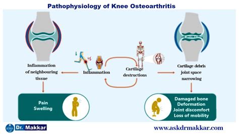 Osteo Arthritis Online Homeopathic Treatment india OA and Joints related diseases