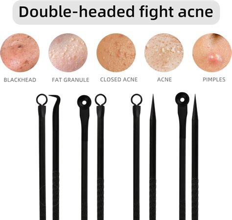 Duduer Blackhead Remover Pimple Popper Tool Kit for Acne Extraction on ...