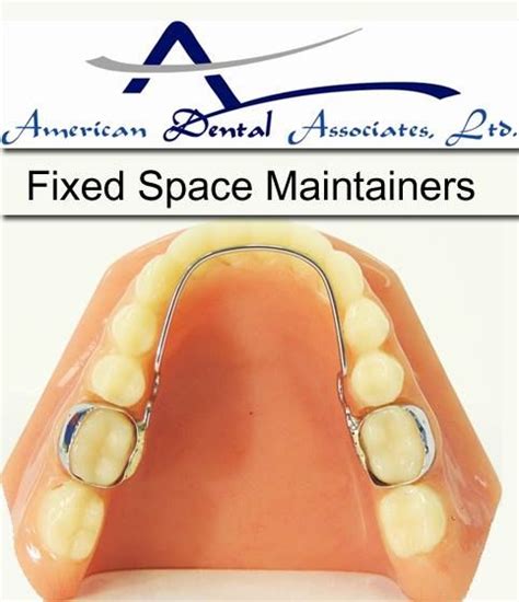 Early tooth loss may require a space maintainer which allows the permanent tooth. There are two ...