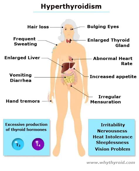 What is TSH ? - Levels, Test, Result, Symptoms, Pregnancy - Why Thyroid