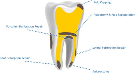 E MTA | Kidsedental