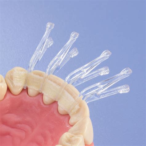 Dental Trauma Splint