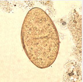 Fasciolopsis buski egg | Medical Laboratories