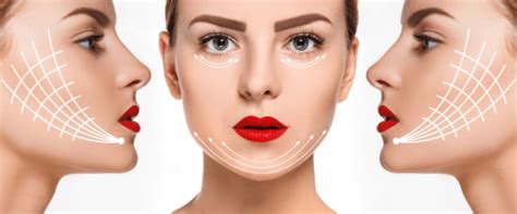 V-line Surgery in Korea - How to Get V-Line Face - Seoul Guide Medical