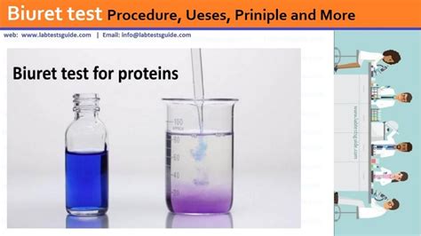 Biuret test | Lab Tests Guide